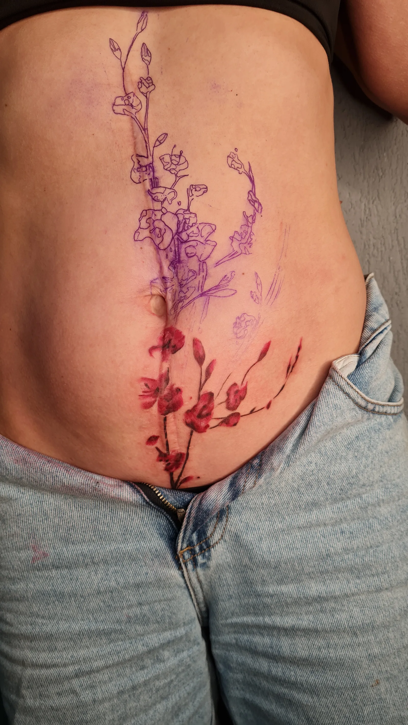 Camuflagem de cicatrizes — Studio Rita Perez